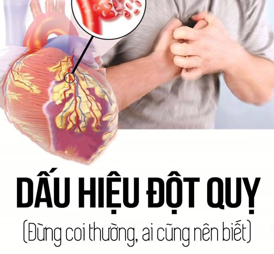 Đột quỵ não: Nhận biết sớm, cấp cứu kịp thời