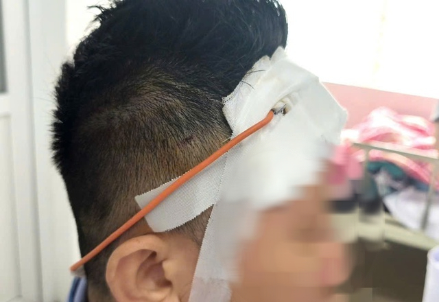 Chấn Thương Sọ Não Có Chữa Được Không? 1 Chấn Thương Sọ Não Có Chữa Được Không?