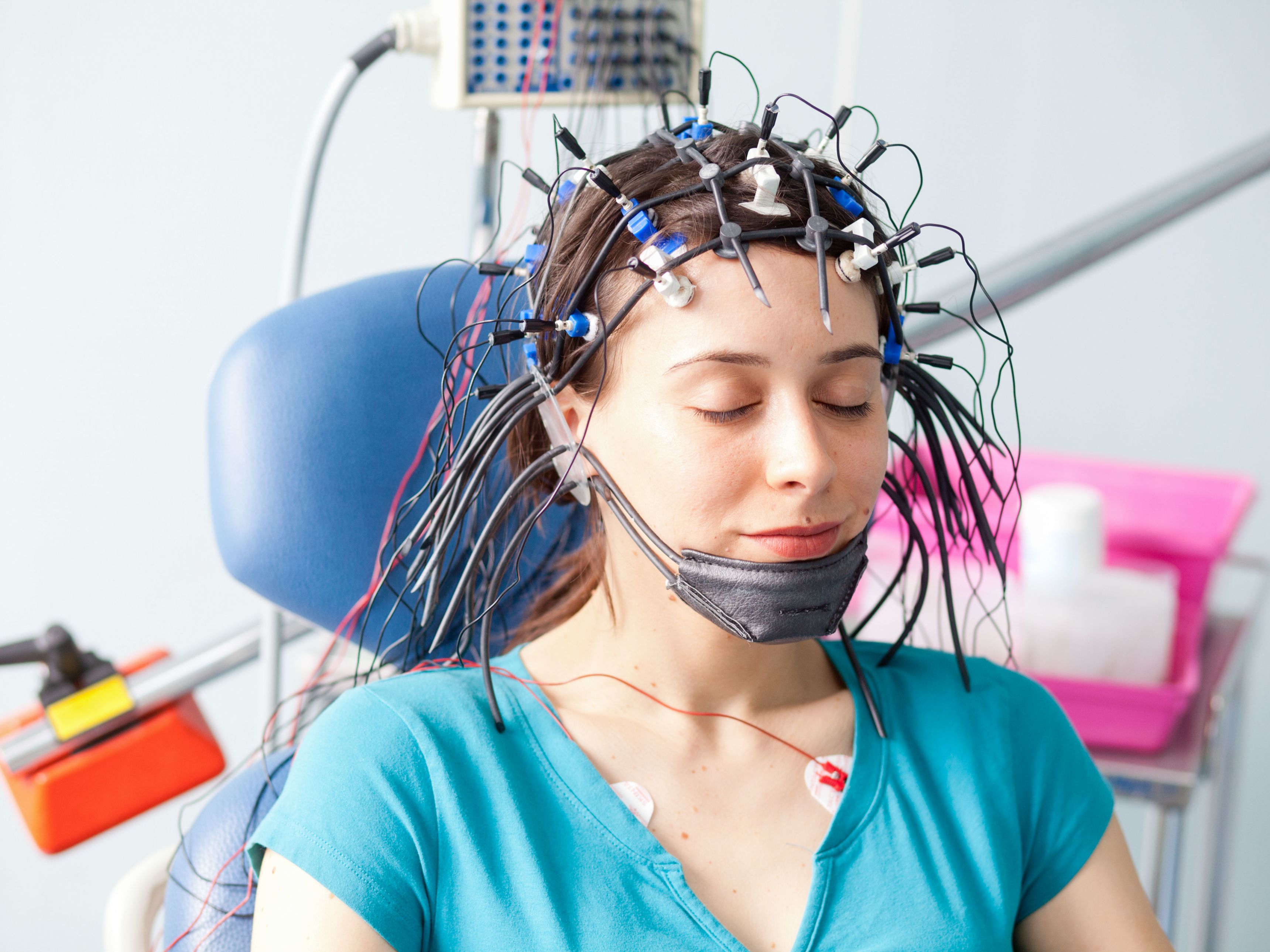 Động kinh cục bộ là gì? Triệu chứng và nguyên nhân